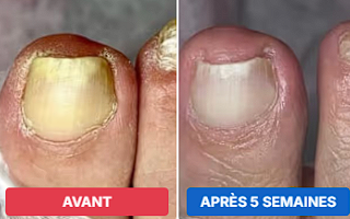 Antes e depois — Sofia