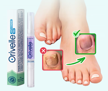 OngleVita — antes e depois em unhas dos pés