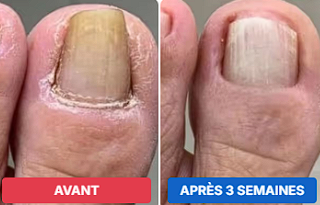 Antes e depois — Thiago